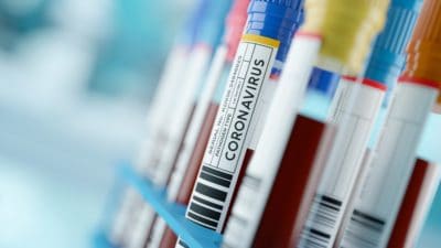 Coronavirus 2019-nCoV Blood Samples Medical Concept